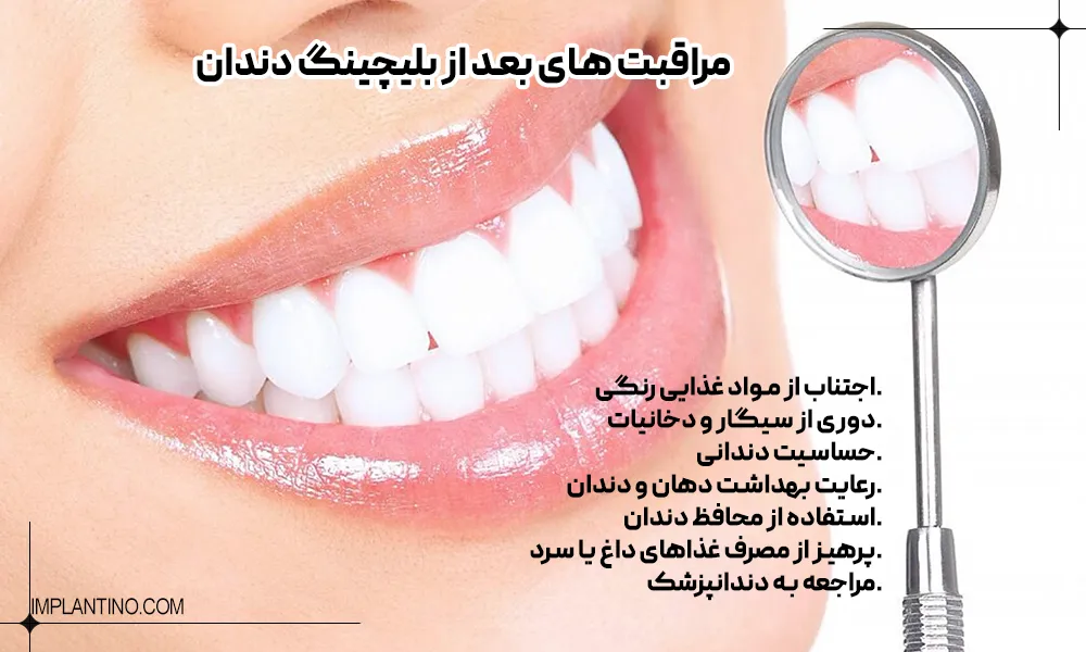 بلیچینگ دندان 5 لبخند خانمی با دندان بلیچینک شده سفید و رعایت مراقبت های بعد از بلیچینگ دندان