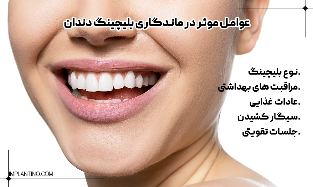 بلیچینگ دندان 6 خانمی که بعد از بلیچینگ دندان های خود به فکر افزایش ماندگاری آن است.