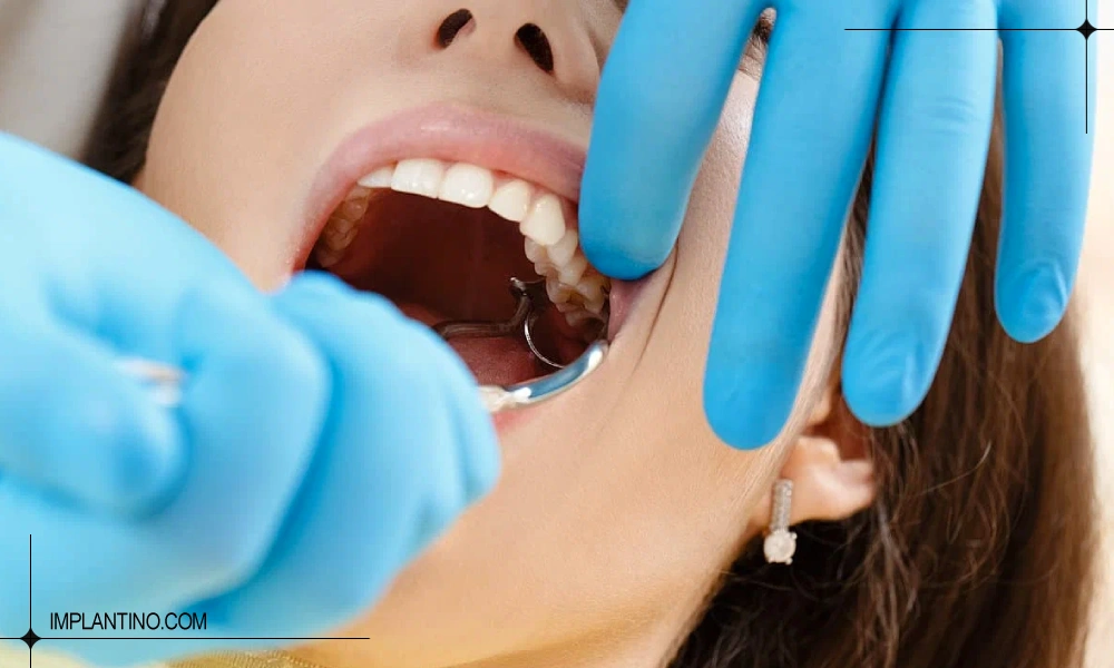 جراحی دندان 2 جراحی دندان عقل برای بک خانم با دهانی باز و تزریق سر کننده