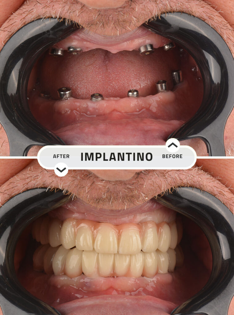Beige White Minimlasit Before After Beauty Skincare Your Story -