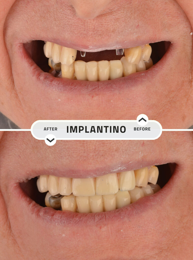 Beige White Minimlasit Before After Beauty Skincare Your Story -