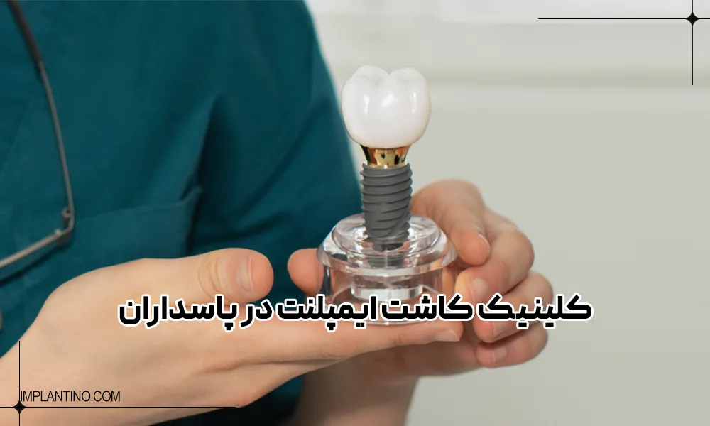 یافتن بهترین کلینیک ایمپلنت در پاسداران