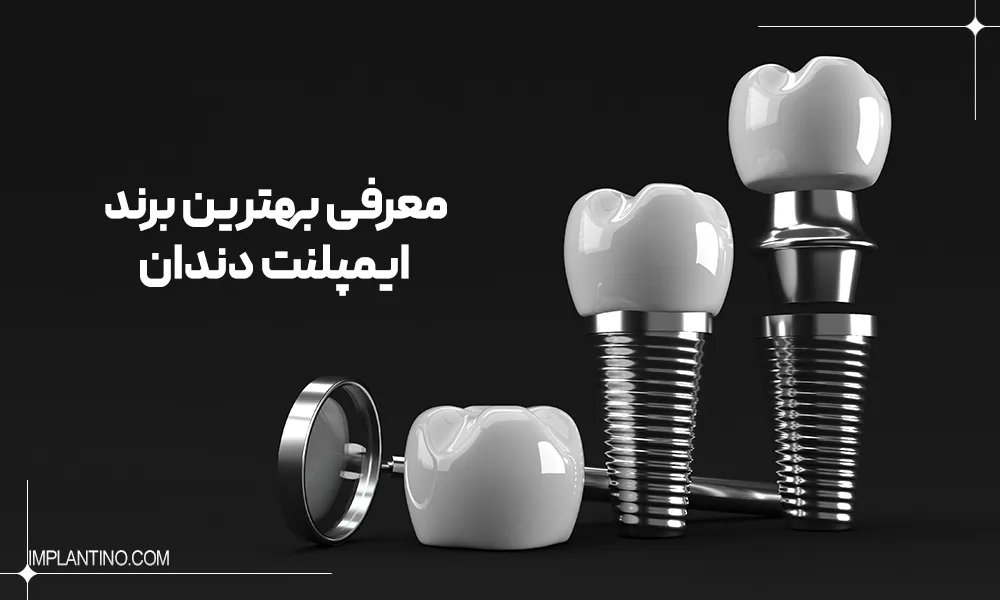 معرفی بهترین برند ایمپلنت دندان
