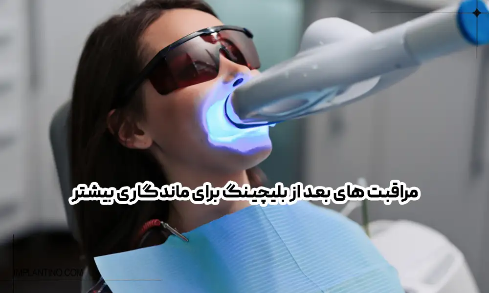 چه مراقبت های ماندگاری بلیچینگ دندان را افزایش می دهد؟