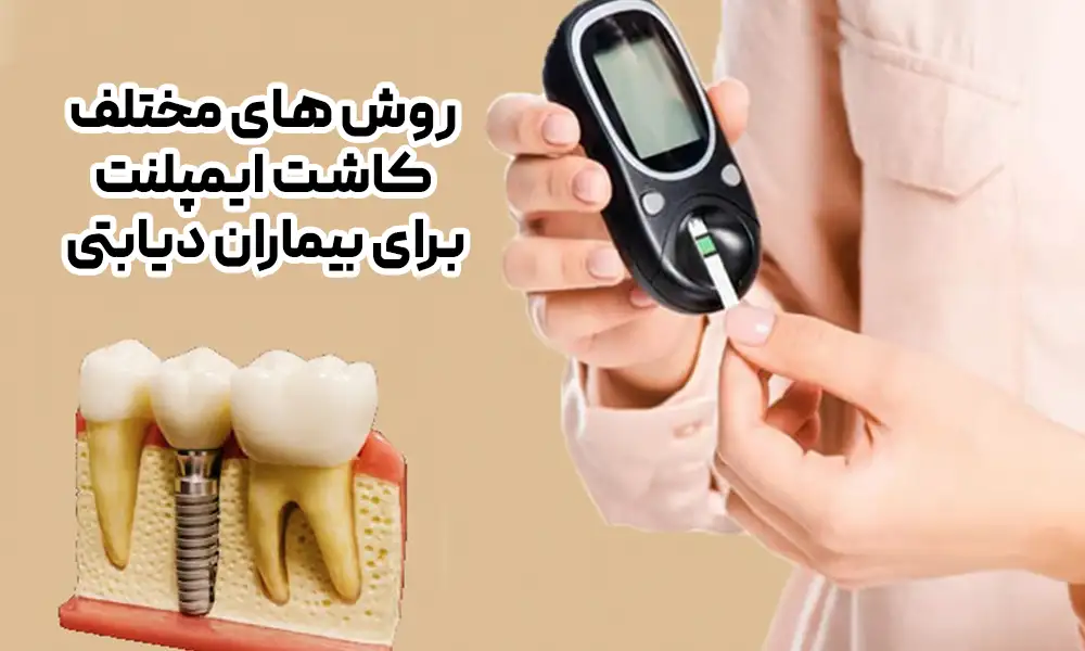 ایمپلنت دندان برای افراد دیابتی امکانپذیر است؟ 2 عکس تست دیابت و ایمپلنت | ایمپلنت دندان برای افراد دیابتی