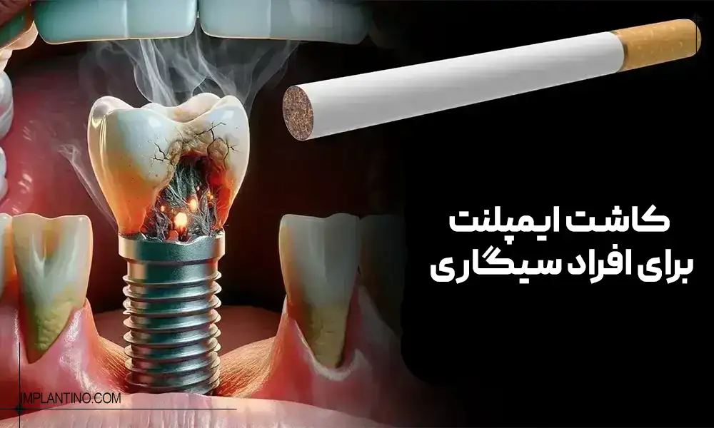 تاثیر سیگار بر روی ایمپلنت دندان 1 Implants for smokers