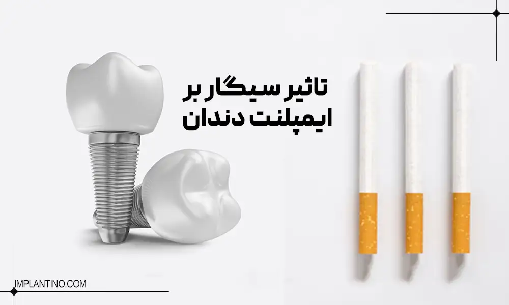 تاثیر سیگار بر روی ایمپلنت دندان 2 The effect of smoking on dental implant