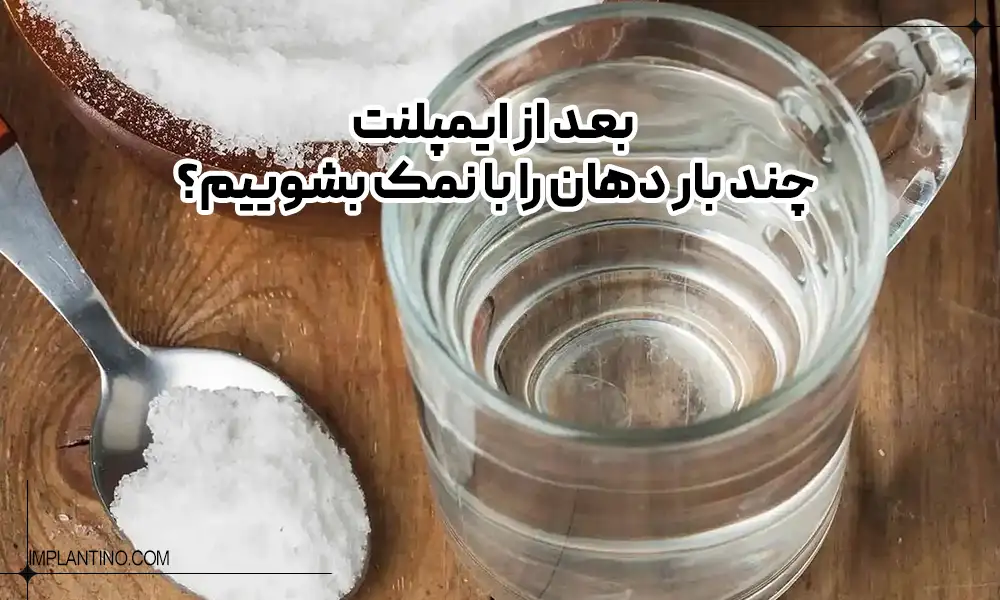 How many times should we rinse our mouth with salt after implants